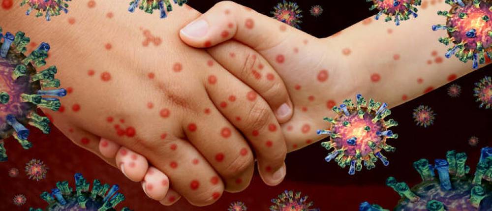 Communicable Diseases
