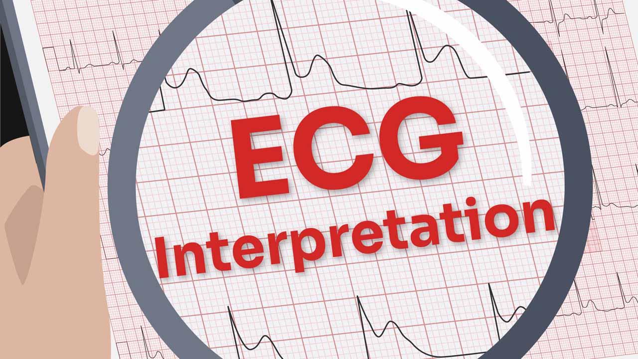 ECG for Interpretation