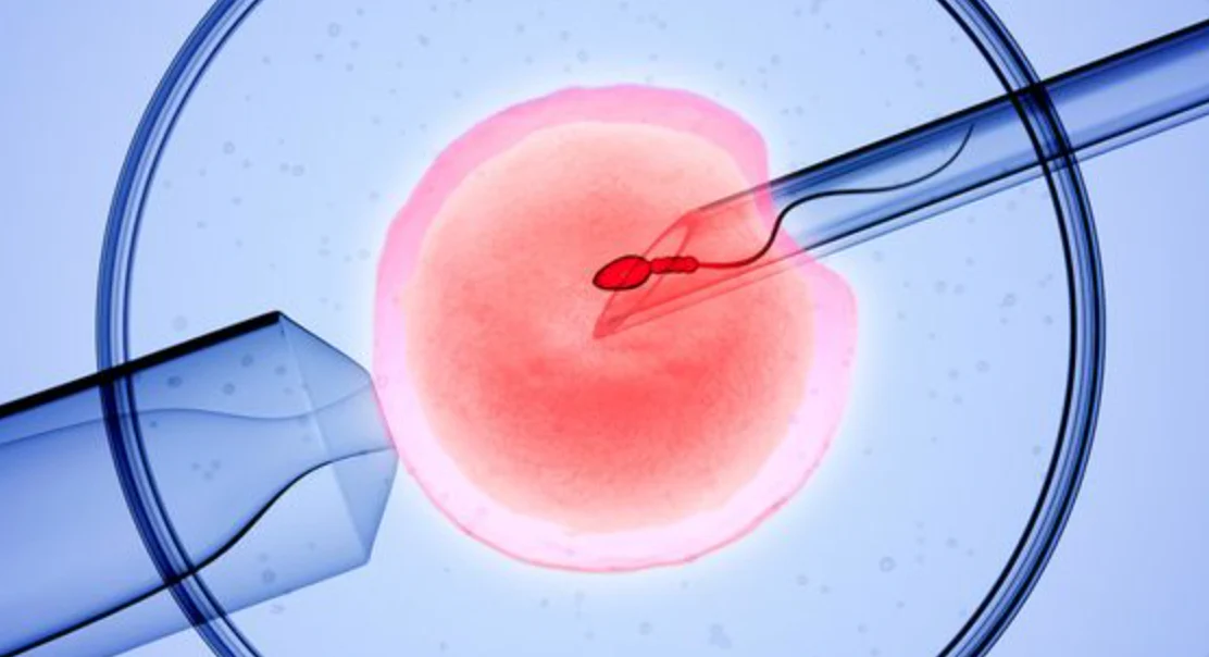Essentials of IVF